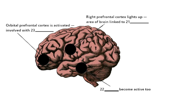 Brain Diagram